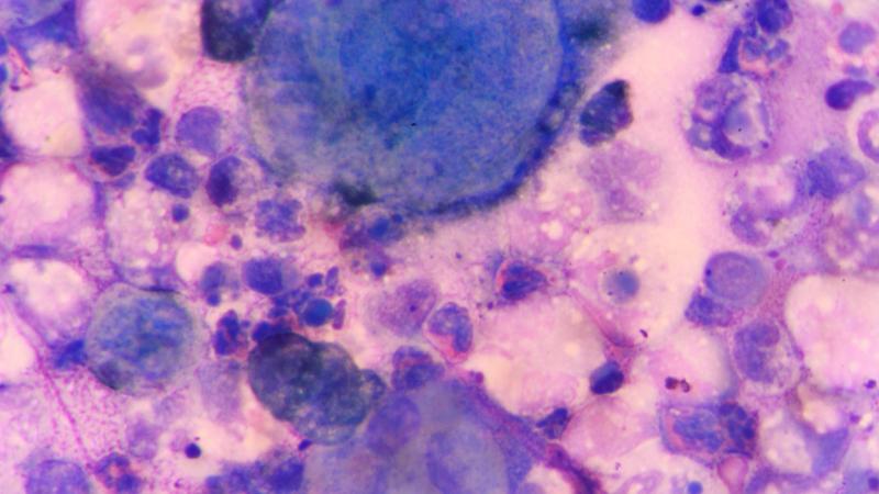 Veszélyes vírus bukkant fel - A láz máris szedi áldozatait.